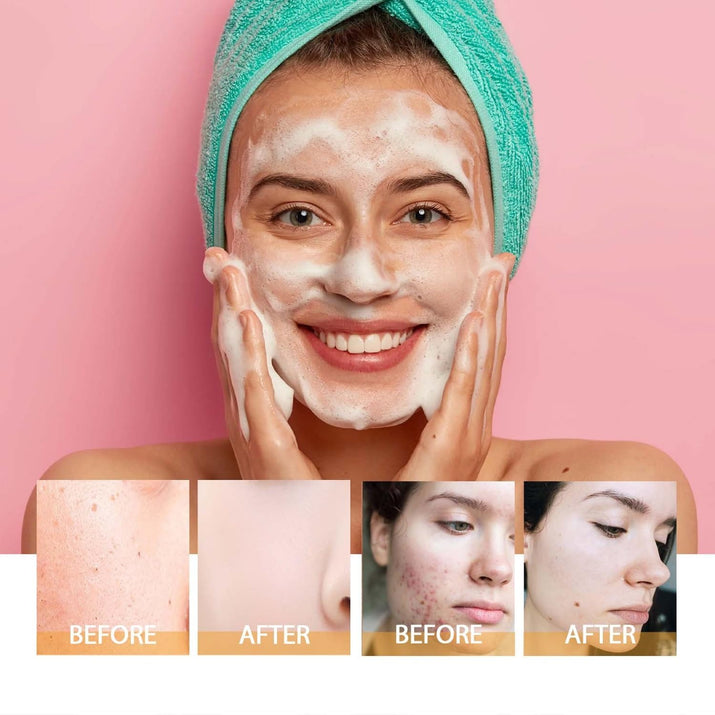 Turmeric Facial Cleanser,Foaming Face Wash,Turmeric Glow Wash,Deep Cleansing Face Cleanser with Brush (100Ml)